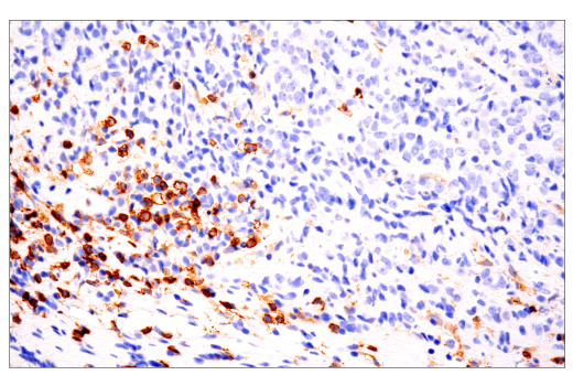 Immunohistochemistry Image 2: CD4 (EP204) Rabbit mAb