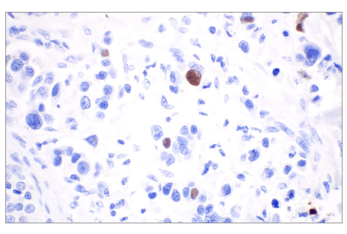 undefined Image 13: Non-Homologous End Joining (NHEJ) DNA Repair Antibody Sampler Kit