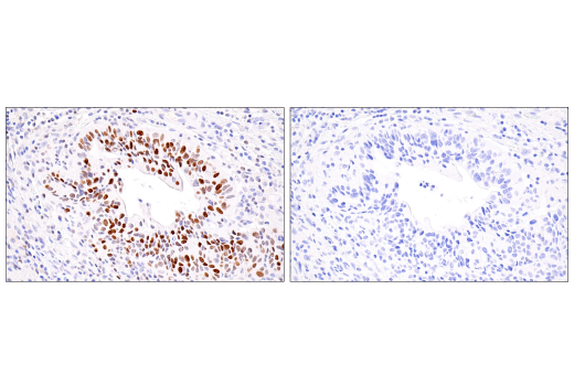 Immunohistochemistry Image 7: ATAD2 (E8Y7F) Rabbit mAb