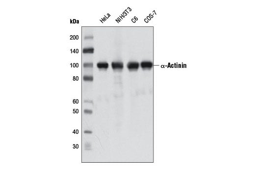 Western Blotting Image 1: α-Actinin (D6F6) XP<sup>®</sup> Rabbit mAb