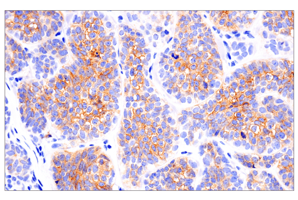 Immunohistochemistry Image 3: FGF Receptor 2 (D4L2V) Rabbit mAb (BSA and Azide Free)