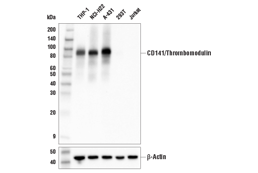 Western Blotting Image 1: CD141/Thrombomodulin (E7Y9P) XP<sup>®</sup> Rabbit mAb (BSA and Azide Free)