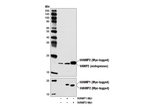 Western Blotting Image 2: VAMP2 (D6O1A) Rabbit mAb