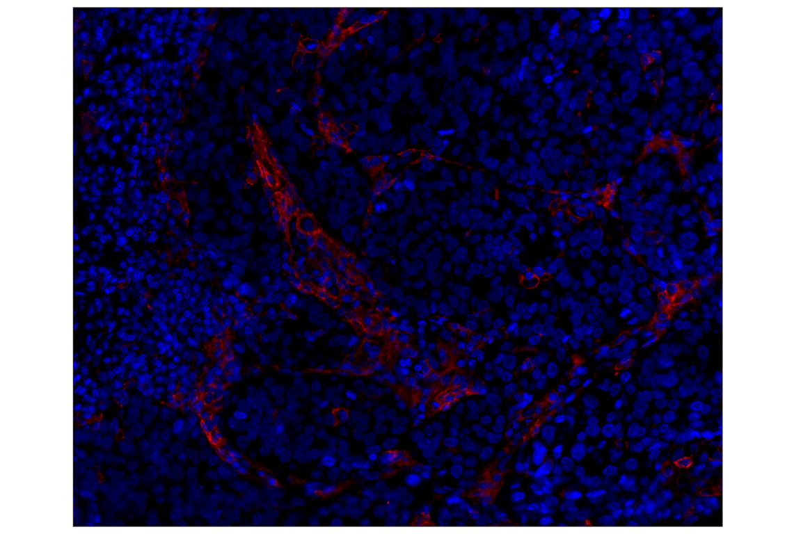 Immunohistochemistry Image 1: CD14 (D7A2T) Rabbit mAb (Alexa Fluor<sup>®</sup> 555 Conjugate)
