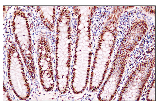 Immunohistochemistry Image 1: ADAR1 (E6X9R) XP<sup>®</sup> Rabbit mAb