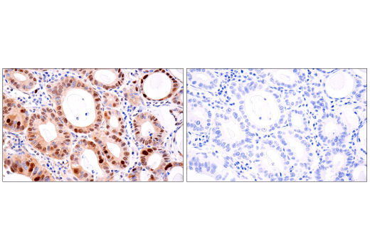 Immunohistochemistry Image 5: CDK2 (E8J9T) XP<sup>®</sup> Rabbit mAb (BSA and Azide Free)