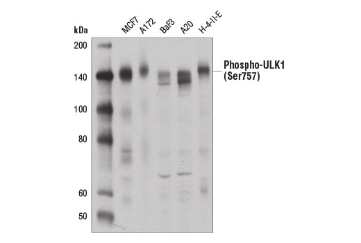 undefined Image 3: PhosphoPlus<sup>®</sup> ULK1 (Ser757) Antibody Duet