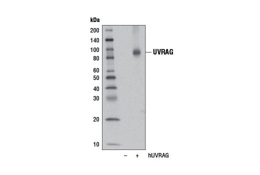 undefined Image 8: Beclin-1 Complex Antibody Sampler Kit