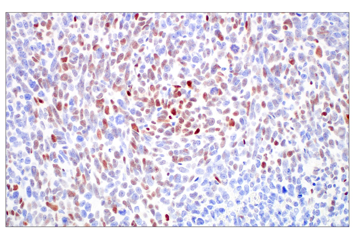 Immunohistochemistry Image 7: c-Fos (E2I7R) XP<sup>®</sup> Rabbit mAb