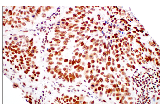 Immunohistochemistry Image 2: METTL3 (E3F2A) Rabbit mAb (BSA and Azide Free)