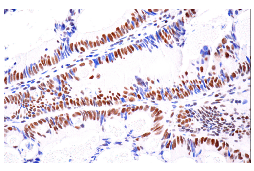 Immunohistochemistry Image 2: ATRX (E5X7O) Rabbit mAb (BSA and Azide Free)