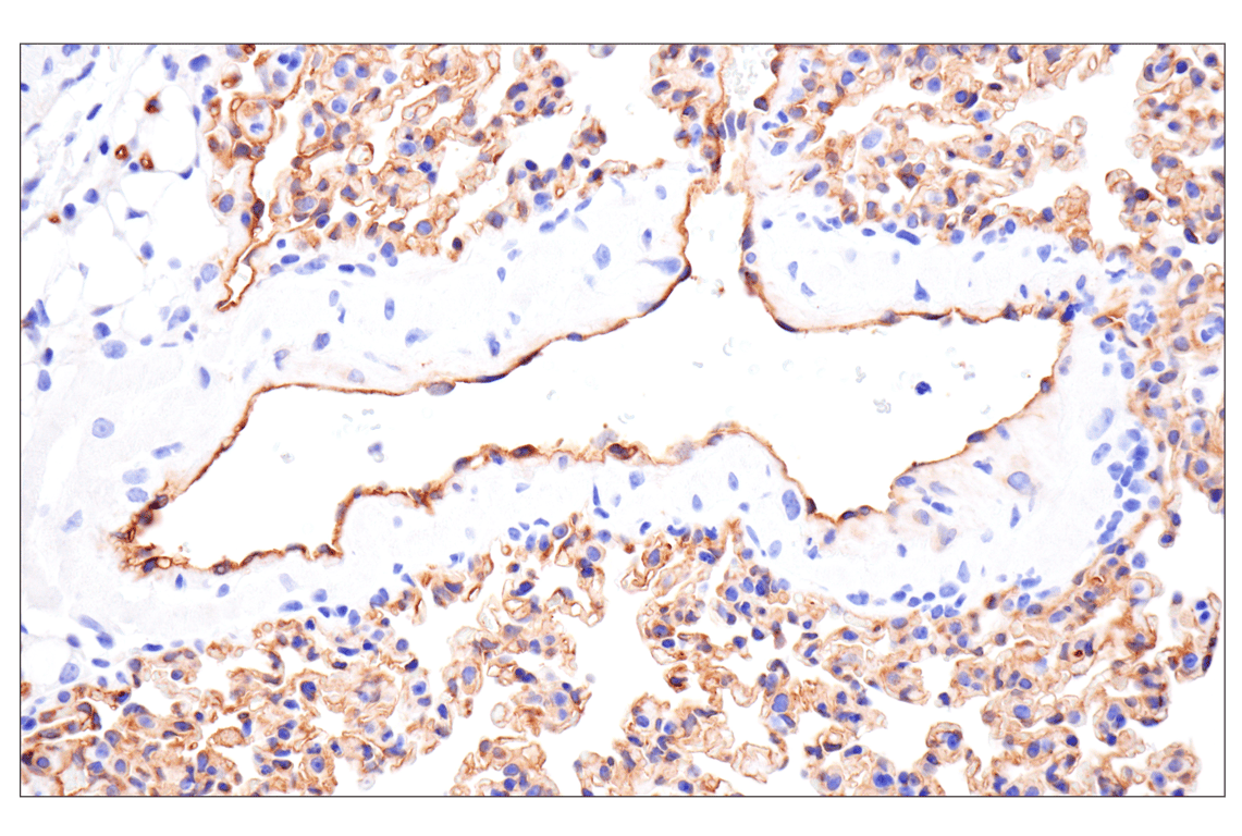 Immunohistochemistry Image 4: ESAM (F9D9P) Rabbit mAb
