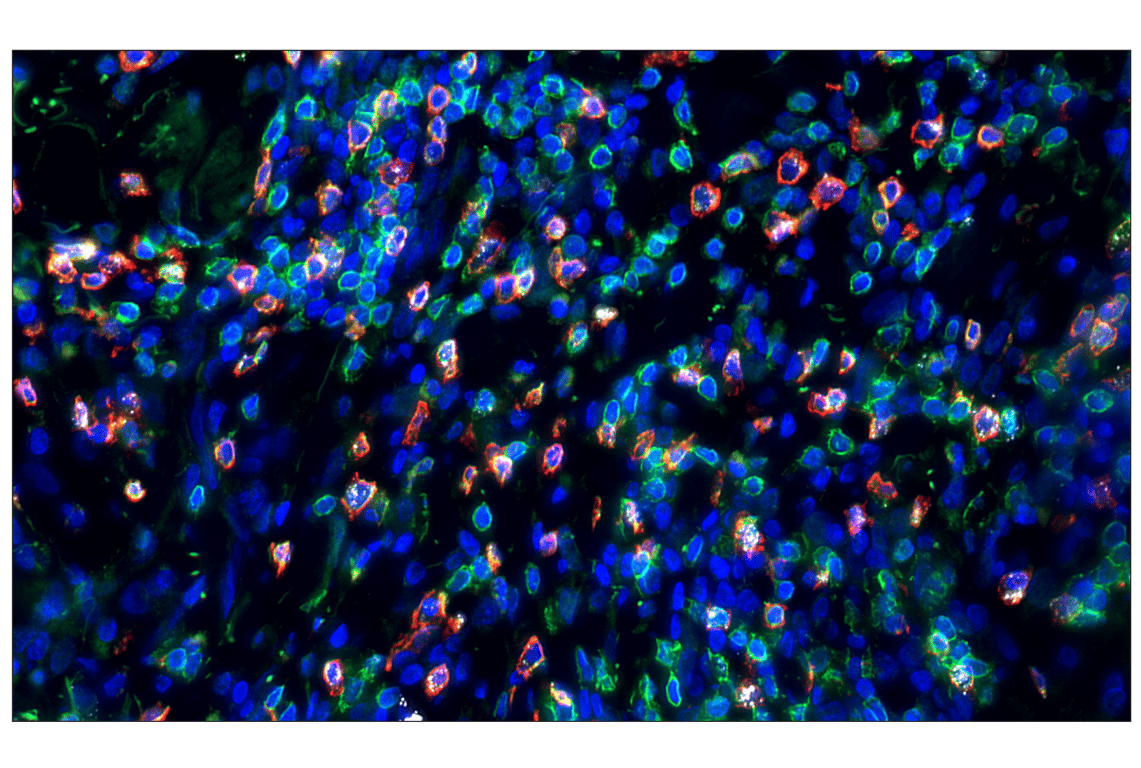 Immunohistochemistry Image 2: Granzyme B (D6E9W) Rabbit mAb (Alexa Fluor<sup>®</sup> 647 Conjugate)