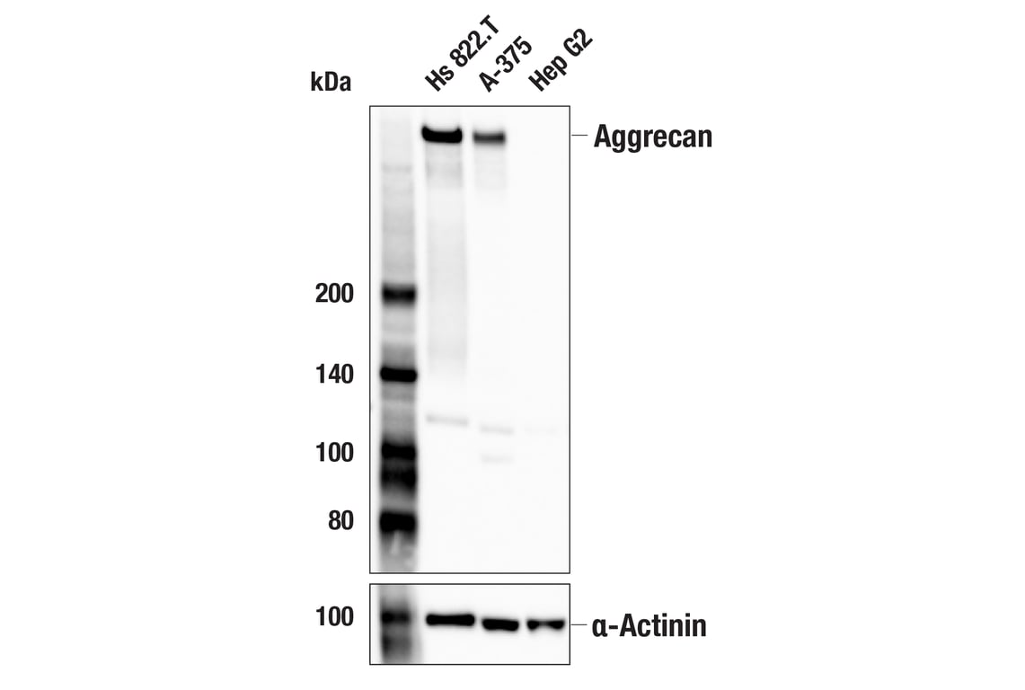 Western Blotting Image 2: Aggrecan (E8B8S) Rabbit mAb