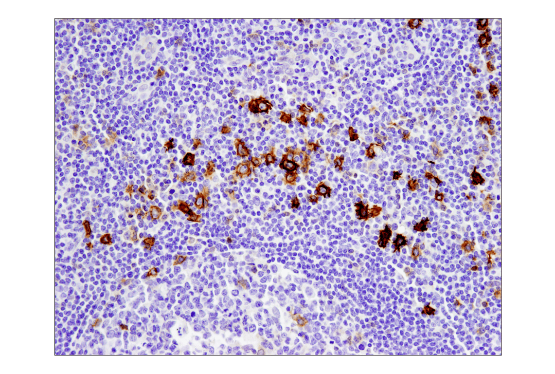 Immunohistochemistry Image 6: TNFRSF8/CD30 (E4L4I) XP<sup>®</sup> Rabbit mAb (BSA and Azide Free)