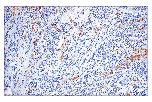 Immunohistochemistry Image 2: CD86 (E2G8P) Rabbit mAb
