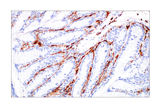 undefined Image 63: Mouse Reactive M1 vs M2 Macrophage IHC Antibody Sampler Kit