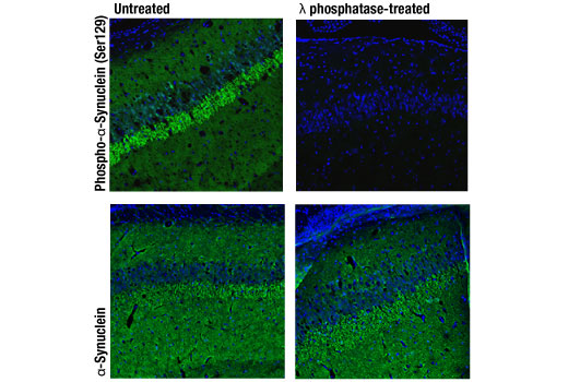 Immunofluorescence Image 2: Phospho-α-Synuclein (Ser129) (D1R1R) Rabbit mAb