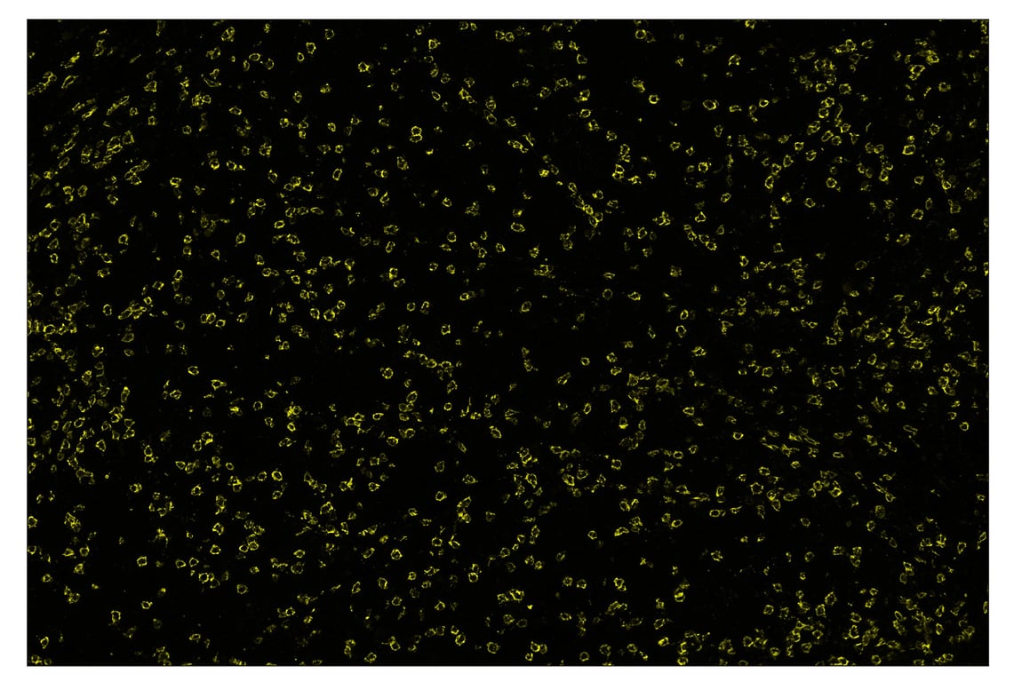 Immunohistochemistry Image 3: CD8α (D8A8Y) & CO-0004-647 SignalStar<sup>™</sup> Oligo-Antibody Pair