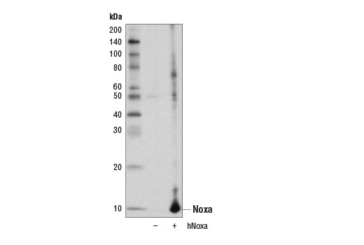 undefined Image 21: Pro-Apoptosis Bcl-2 Family Antibody Sampler Kit II