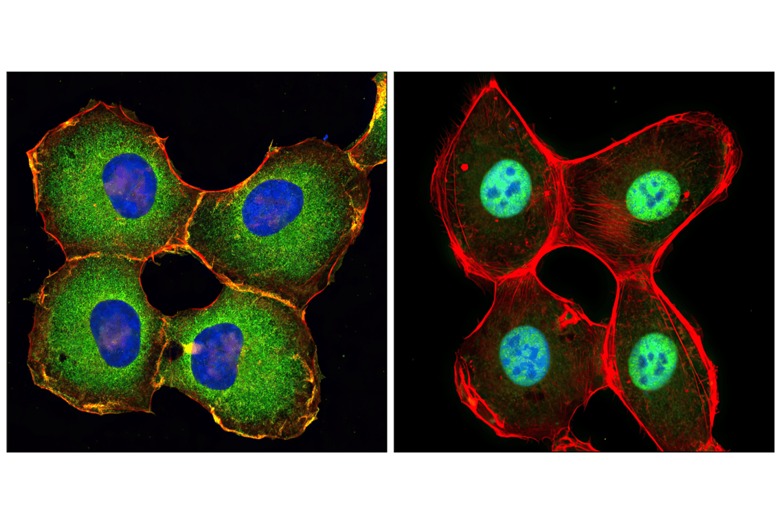 undefined Image 10: PhosphoPlus<sup>®</sup> NF-κB p65/RelA (Ser536) Antibody Duet