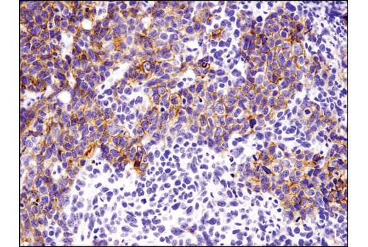 Immunohistochemistry Image 2: E-Cadherin (4A2) Mouse mAb