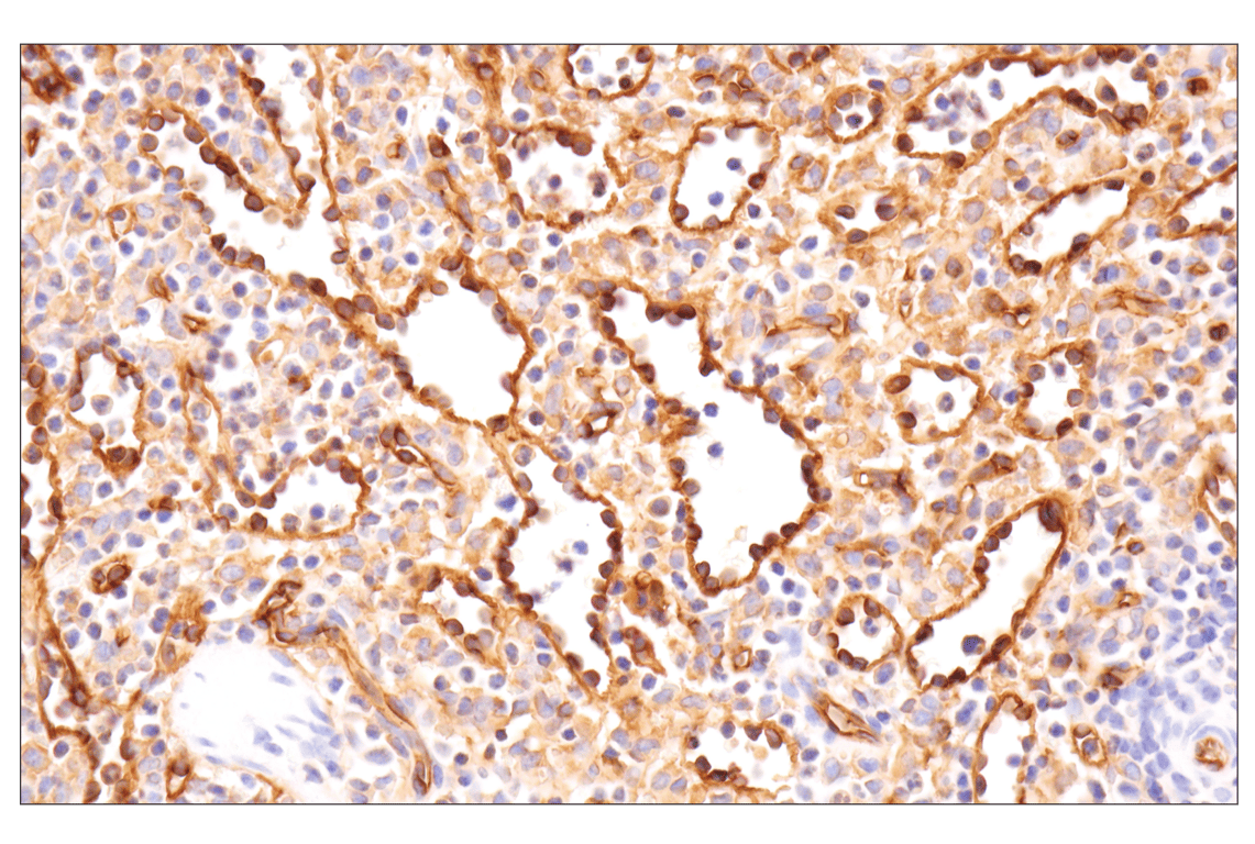 Immunohistochemistry Image 4: CD36 (D8L9T) Rabbit mAb (BSA and Azide Free)