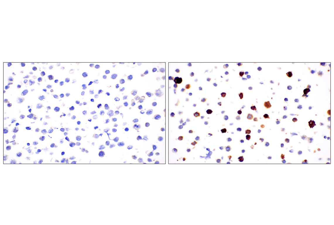 Immunohistochemistry Image 8: PNPLA3 (E7N6O) Rabbit mAb