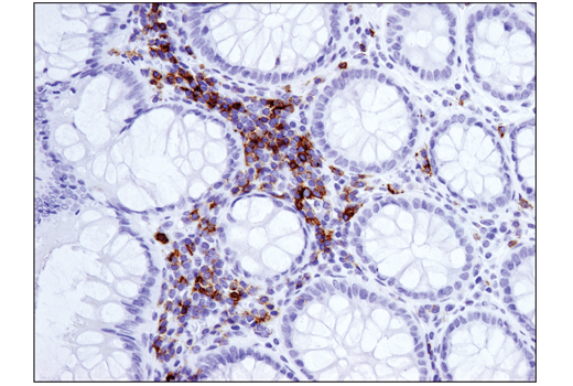 Immunohistochemistry Image 1: ICOS (D1K2T<sup>™</sup>) Rabbit mAb