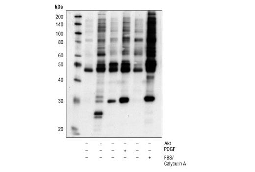 Western Blotting Image 1: Phospho-Akt Substrate (RXXS*/T*) (110B7E) Rabbit mAb