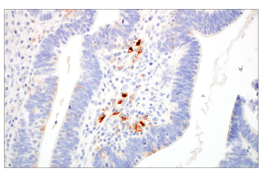 Immunohistochemistry Image 2: LAMP3/CD208 (E6E5U) XP<sup>®</sup> Rabbit mAb (BSA and Azide Free)