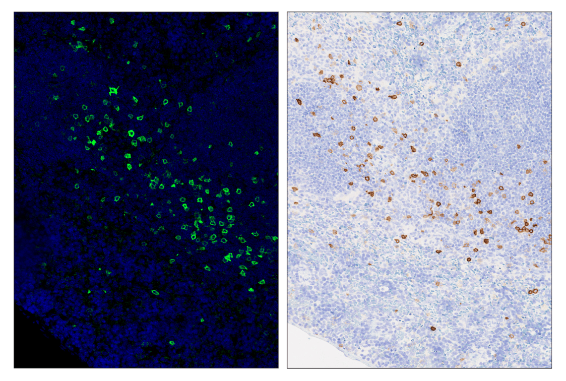 Immunohistochemistry Image 6: IL-2Rα/CD25 (E9W2J) & CO-0074-594 SignalStar<sup>™</sup> Oligo-Antibody Pair