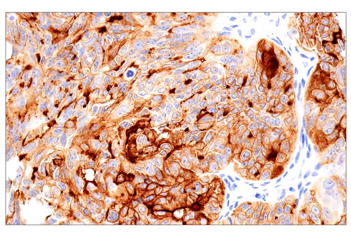 Immunohistochemistry Image 1: Folate Receptor Alpha/FOLR1 (BN3.2) Mouse mAb