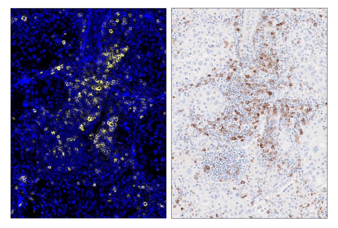 Immunohistochemistry Image 6: ICOS (D1K2T<sup>™</sup>) & CO-0027-594 SignalStar<sup>™</sup> Oligo-Antibody Pair