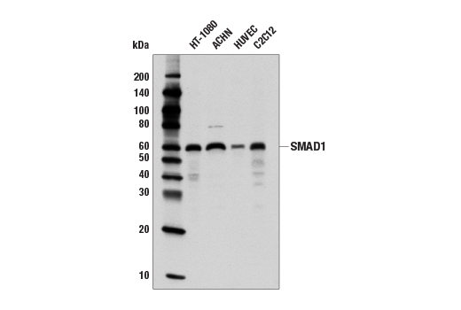 Western Blotting Image 1: SMAD1 (D59D7) XP<sup>®</sup> Rabbit mAb