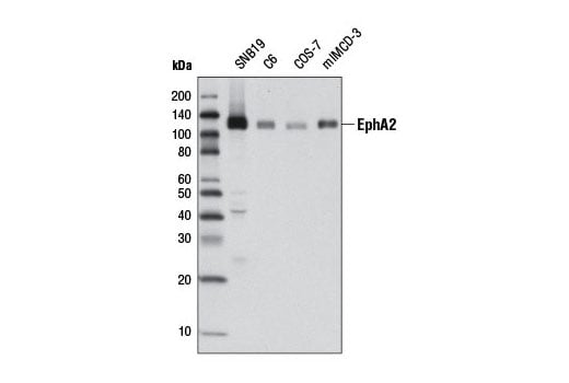 Western Blotting Image 1: EphA2 (D4A2) XP<sup>®</sup> Rabbit mAb