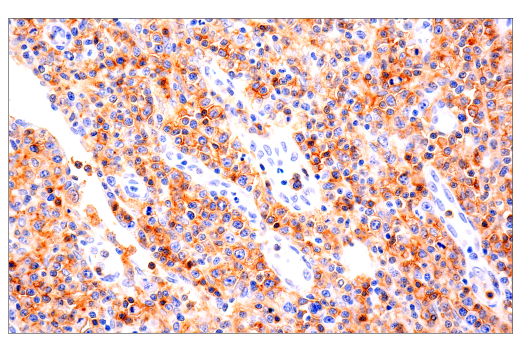 Immunohistochemistry Image 1: CD4 (EP204) Rabbit mAb