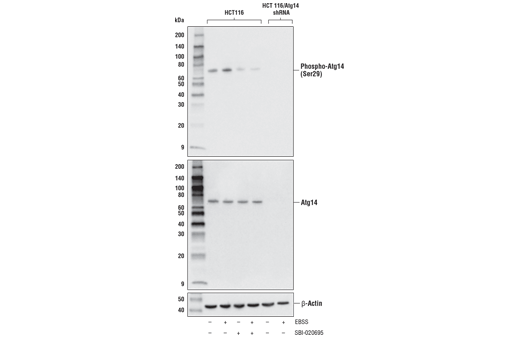undefined Image 19: ULK1 Substrate Antibody Sampler Kit