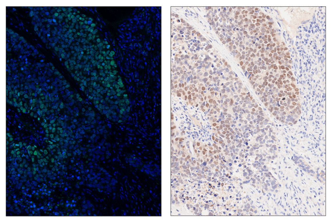Immunohistochemistry Image 2: Ezh2 (D2C9) & CO-0167-594 SignalStar<sup>®</sup> Oligo-Antibody Pair