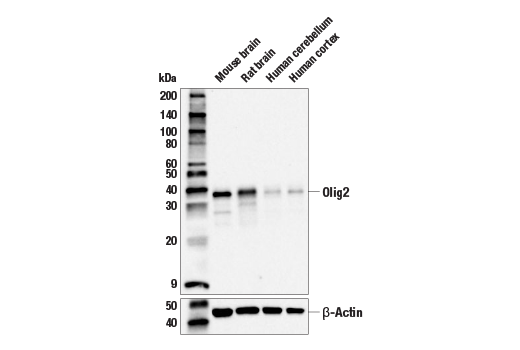 Western Blotting Image 1: Olig2 (E6G6Q) XP<sup>®</sup> Rabbit mAb (BSA and Azide Free)