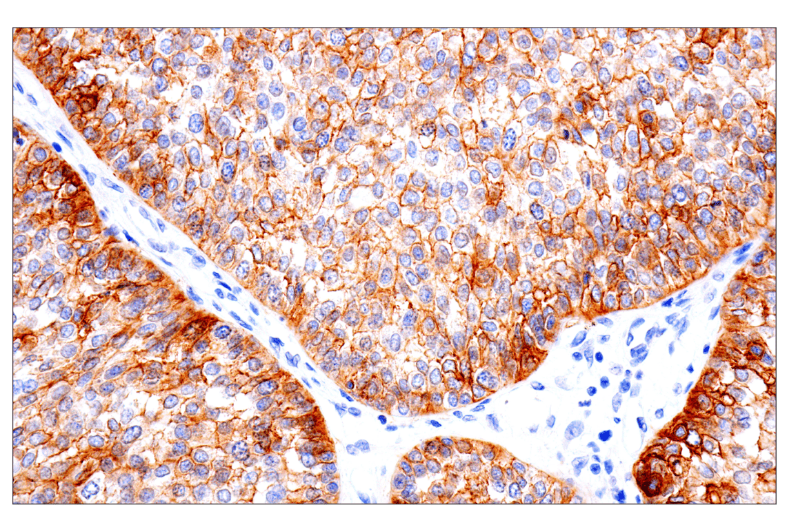 Immunohistochemistry Image 4: Integrin β6 (E4M9P) XP<sup>®</sup> Rabbit mAb