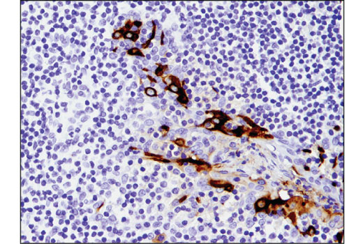 Immunohistochemistry Image 2: Mesothelin (D9R5G) XP<sup>®</sup> Rabbit mAb (BSA and Azide Free)