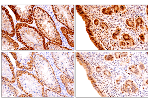Immunohistochemistry Image 4: CDK2 (E8J9T) XP<sup>®</sup> Rabbit mAb (BSA and Azide Free)