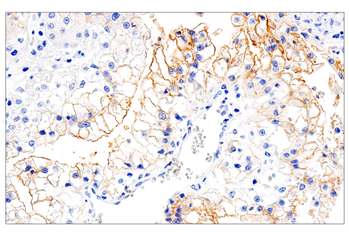 Immunohistochemistry Image 4: Folate Receptor Alpha/FOLR1 (BN3.2) Mouse mAb