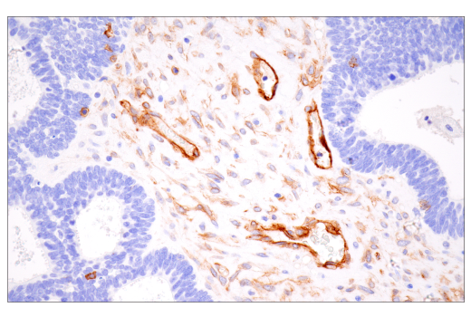 Immunohistochemistry Image 1: Integrin α1/CD49a (E9K2J) XP<sup>®</sup> Rabbit mAb (BSA and Azide Free)