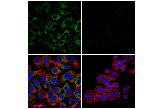 Immunofluorescence Image 1: α-2-Macroglobulin (E4H4U) Rabbit mAb