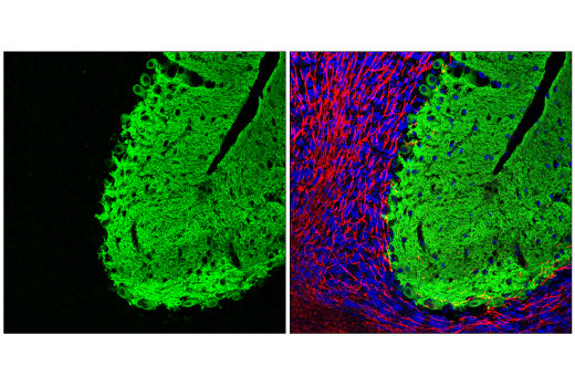 Immunofluorescence Image 1: EAAT4 (E6E9I) Rabbit mAb