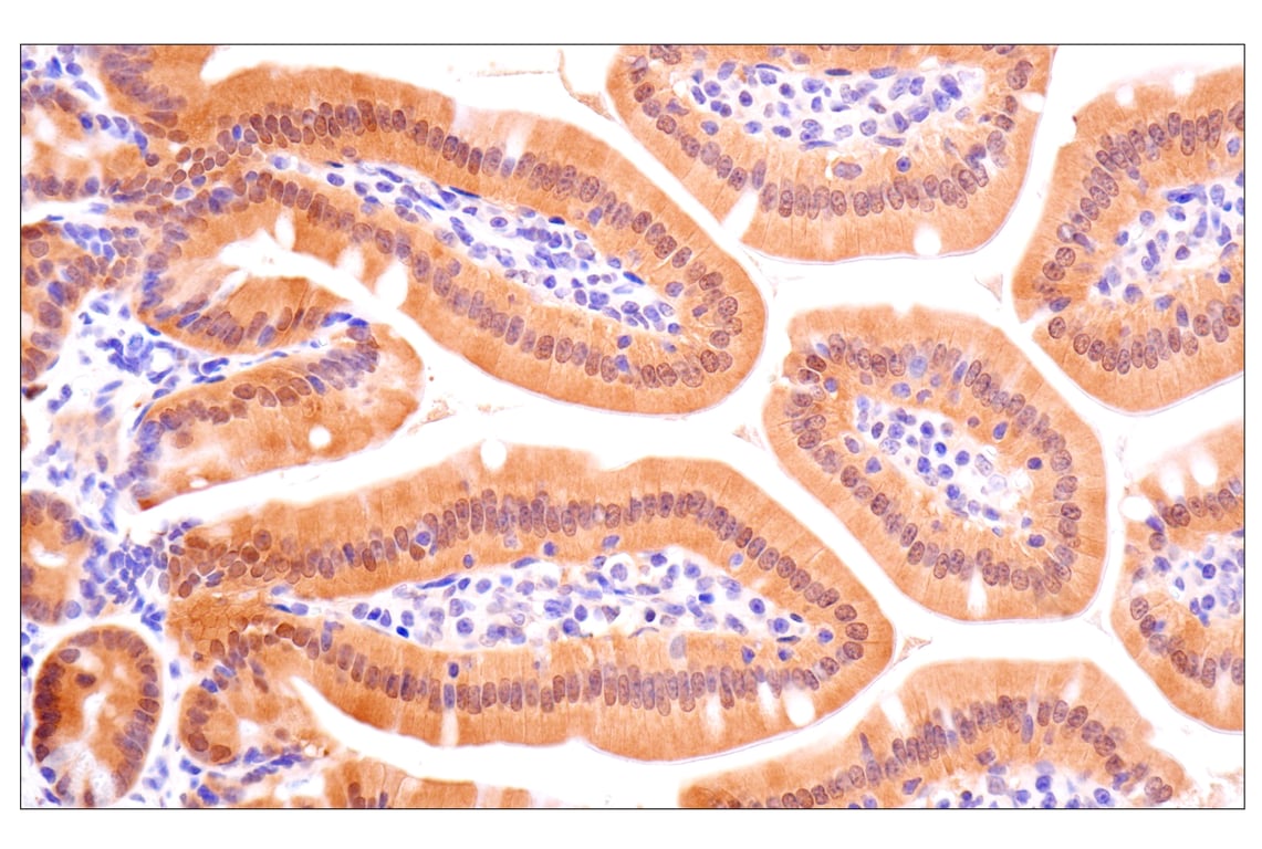 Immunohistochemistry Image 10: ACBP/DBI (E4V8V) XP<sup>®</sup> Rabbit mAb