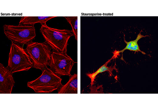 undefined Image 10: Apoptosis Antibody Sampler Kit II