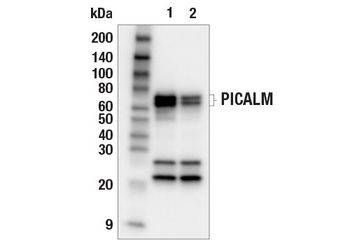 undefined Image 10: PICALM Signaling Antibody Sampler Kit